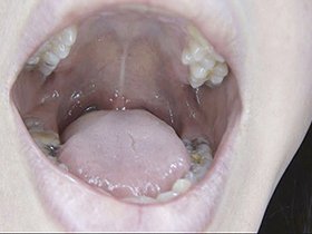 300人のおくち 第2集　サンプル画像06